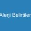 Alerji Belirtileri