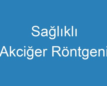 Sağlıklı Akciğer Röntgeni