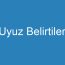 Uyuz Belirtileri