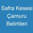 Safra Kesesi Çamuru Belirtileri