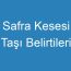 Safra Kesesi Taşı Belirtileri