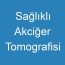 Sağlıklı Akciğer Tomografisi