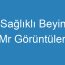 Sağlıklı Beyin Mr Görüntüleri