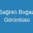 Sağlıklı Boğaz Görüntüsü