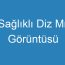 Sağlıklı Diz Mr Görüntüsü