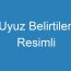 Uyuz Belirtileri Resimli