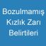 Bozulmamış Kızlık Zarı Belirtileri