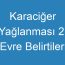 Karaciğer Yağlanması 2. Evre Belirtileri