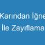 Karından İğne İle Zayıflama