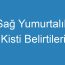 Sağ Yumurtalık Kisti Belirtileri