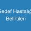 Sedef Hastalığı Belirtileri