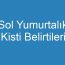 Sol Yumurtalık Kisti Belirtileri