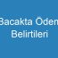 Bacakta Ödem Belirtileri