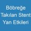 Böbreğe Takılan Stent Yan Etkileri