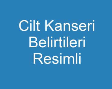 Cilt Kanseri Belirtileri Resimli