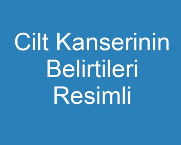 Cilt Kanserinin Belirtileri Resimli