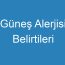 Güneş Alerjisi Belirtileri