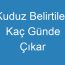 Kuduz Belirtileri Kaç Günde Çıkar