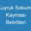 Kuyruk Sokumu Kayması Belirtileri