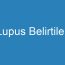 Lupus Belirtileri