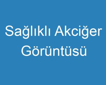 Sağlıklı Akciğer Görüntüsü